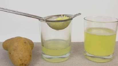 മുഖത്തെ പാടുകള്‍ മാറ്റും; ഉരുളക്കിഴങ്ങ് കൊണ്ട് ചര്‍മ്മം  സംരക്ഷിക്കാനുളള ചില വഴികള്‍...