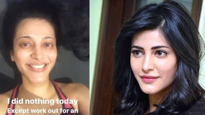 When Shruti Haasan opened up about her struggle with PCOS; spoke on 'plastic surgery'