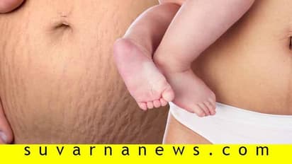 ತಾಯಿಯಾದ ಮೇಲೂ ತ್ವಚೆಯ ರಂಗು ಕಾಪಾಡಿಕೊಳ್ಳುವುದು ಹೇಗೆ?