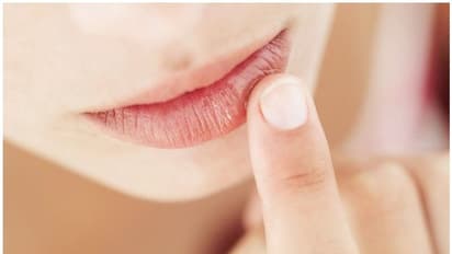 Health Tips :  വെയിലേറ്റ് ചുണ്ട് ഡ്രൈ ആകാതിരിക്കാനും പൊള്ളലേല്‍ക്കാതിരിക്കാനും ചെയ്യേണ്ടത്...