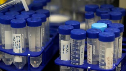 कोरोना के खिलाफ बड़ी जीत, मिल गई ऐसी दवा जो वायरस के 99% असर को कर देगी खत्म