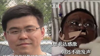 कोरोना में बदल गया था डॉक्टर की चमड़ी का रंग, 5 महीने मौत से लड़ने के बाद आखिरकार हार गया योद्धा