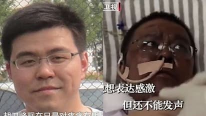 കൊവിഡ് ബാധിച്ച് ശരീരത്തിന്റെ നിറം മാറി; ഒടുവില് മരണത്തിന് കീഴടങ്ങി ഡോക്ടര്...