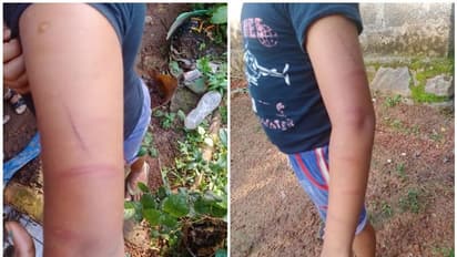 മൂന്നാം ക്ലാസുകാരന് ട്യൂഷന് ക്ലാസില് മര്ദ്ദനം; വാര്ഡ് മെമ്പറുടെ പരാതിയില് അധ്യാപകനെതിരേ കേസ്