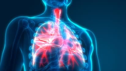 ന്യുമോണിയ; അറിയേണ്ട ചില കാര്യങ്ങൾ