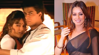 Did you know 67 glass pieces were extracted from this top Bollywood actress’ face