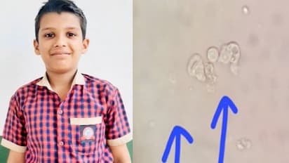 നീന്തല്‍ക്കുളത്തില്‍ അധികനേരം ചിലവിട്ടു; തലച്ചോറില്‍ 'അമീബ' കയറി കോട്ടയ്ക്കലിൽ പന്ത്രണ്ടുകാരന്‍ മരിച്ചു