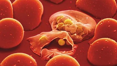 मलेरिया रोग को दूर करने के घरेलू उपाय , जानें इसके लक्षण और बचाव के तरीके