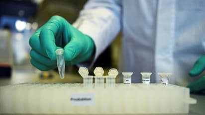 കൊവിഡ് വാക്സിൻ വികസിപ്പിക്കുന്ന കമ്പനിയുടെ ഓഹരി ജർമ്മൻ സർക്കാർ വാങ്ങുന്നു