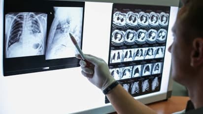 'കൊവിഡ് 19 ചിലരില് ഗുരുതരമാകും'; ശ്രദ്ധിക്കേണ്ടവര് ഇവരാണ്...