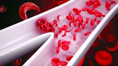 കയ്യിലും കാലിലും വീക്കം, കാഴ്ചാപ്രശ്നങ്ങള്; അറിയാം ഈ രോഗത്തെ...