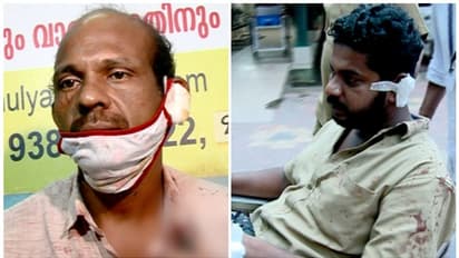 ഭാര്യയുമായി ബന്ധമുണ്ടെന്ന് സംശയം; ഡ്രൈവറുടെ ചെവി ഭര്‍ത്താവ് കടിച്ചുമുറിച്ചു