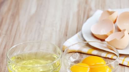 കണ്ണിന് ചുറ്റുമുള്ള കറുപ്പാണോ പ്രശ്നം...? വീട്ടിലുണ്ട് പരിഹാരം