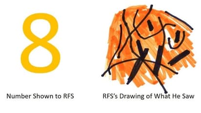 രണ്ട് മുതല്‍ ഒമ്പതുവരെ അക്കങ്ങള്‍ തിരിച്ചറിയാനാകില്ല, പ്രത്യേക അവസ്ഥയുമായി ഒരാള്‍...