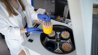 గుడ్న్యూస్: 60 మంది కరోనా రోగులపై సిద్ద థెరపీతో స్టడీ