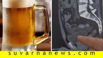 10 ಬಾಟಲ್ ಬಿಯರ್ ಕುಡಿದು, 18 ಗಂಟೆ ಮೂತ್ರ ಹಿಡಿದಿಟ್ಟಾತನ ಕಥೆ ಕೇಳಿ...!