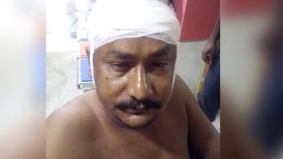 বজবজের পুজালিতে তৃণমূল কাউন্সিলরকে ধারালো অস্ত্রের কোপ, আটক ২