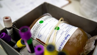 வேலைக்காகதா பிளாஸ்மா சிகிச்சை? கைவிட மத்திய அரசு அதிரடி முடிவு..!