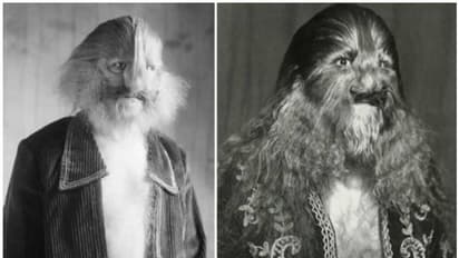 ശരീരം മുഴുവൻ മുടി, രൂപം കണ്ട് സ്വന്തം അമ്മ പോലും ഉപേക്ഷിച്ചു, ഒടുവില് സര്ക്കസ് കമ്പനിയില് ജീവിതം...