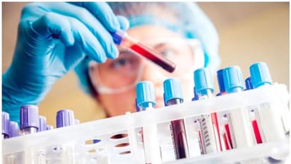 Karnataka: Pooling of COVID-19 samples allowed in districts with less than 5% positivity rate