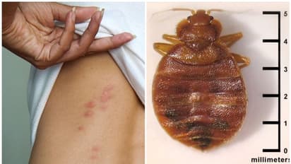 മൂട്ടശല്യം - എങ്ങനെ കണ്ടെത്താം? എങ്ങനെ ഒഴിപ്പിക്കാം? അറിയേണ്ടതെല്ലാം