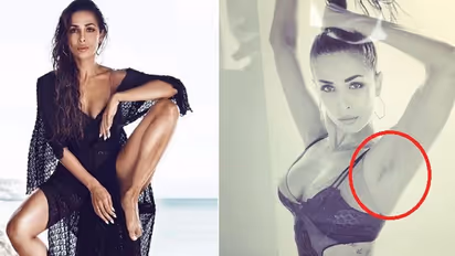 When Malaika Arora's unshaved underarms made headlines