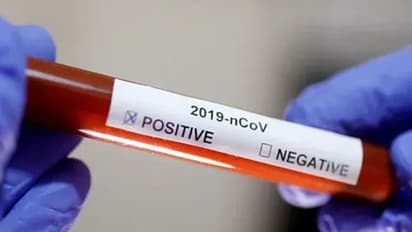 హైదరాబాద్లో కార్పోరేట్ ఆసుపత్రుల దందా.. కరోనా రోగులతో వ్యాపారం