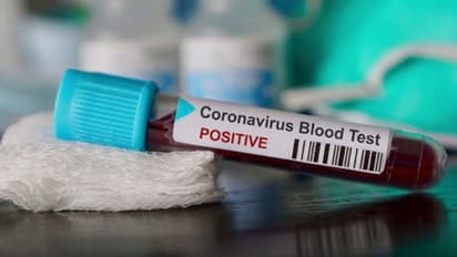 കാൻസർ ബാധിച്ച് ചികിത്സയിലിരിക്കെ മരിച്ച യുവതിക്ക് കൊവിഡ് പോസിറ്റീവ്