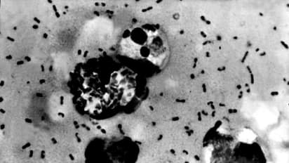 চিনে মহামারির আতঙ্ক তৈরি করা  বিউবনিক প্লেগ কতটা মারাত্মক হতে পারে, জানুন এর  উৎস ও উপসর্গ