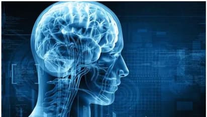 അമിത വണ്ണവും മസ്തിഷ്കത്തിലെ തകരാറുകളും തമ്മിൽ ബന്ധമുണ്ടെന്ന് പഠനം