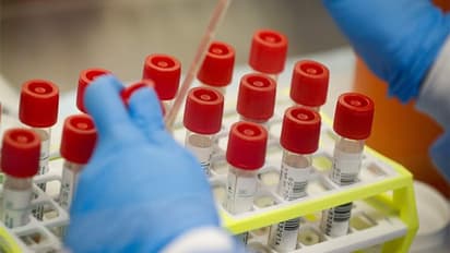 കൊല്ലത്ത് ആശുപത്രി ശുചീകരണ തൊഴിലാളിക്ക് കൊവിഡ്, രോഗം കണ്ടെത്തിയത് ട്രൂ നാറ്റിൽ