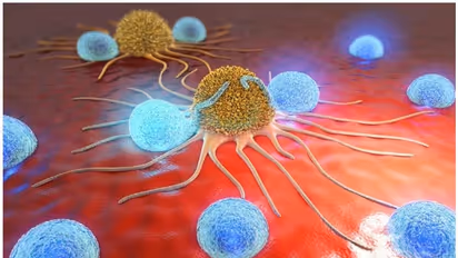 കാൻസർ കോശങ്ങളെ നശിപ്പിക്കുന്ന 'ഫാറ്റി ആസിഡ്' കണ്ടെത്തിയതായി ഗവേഷകർ