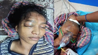 మాస్కు ధరించనందుకు కుటుంబంపై కర్రలతో దాడి... యువతి మృతి