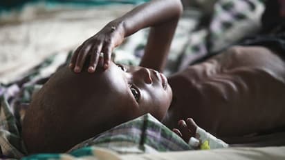 COVID-19 pandemic: 130 million more people may face chronic hunger by end of 2020