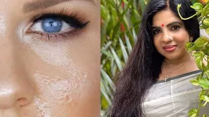 മുഖത്തെ എണ്ണമയം അകറ്റാന്‍ കിടിലന്‍ ഫേസ് പാക്കുമായി മേക്കപ്പ് ആര്‍ട്ടിസ്റ്റ് അനില ജോസഫ് !