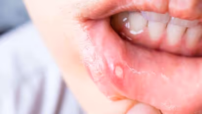 Health Tips: মুখের ভিতর ঘা বা বার বার তেষ্টা পাচ্ছে, তবে আপনারও হতে পারে এই মারাত্মক রোগ