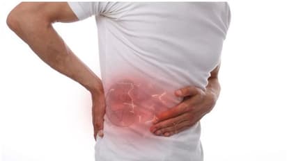 Kidney Stone : മൂത്രത്തില് കല്ലിന് സാധ്യത കൂടുതലും ആര്ക്ക്? ലക്ഷണങ്ങളും അറിയാം...