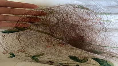 ದೇಹದ ಕೂದಲಲ್ಲಿ ಬದಲಾವಣೆಯಾದ್ರೆ ಅದು ಈ ರೋಗ ಲಕ್ಷಣವೂ ಇರಬಹುದು