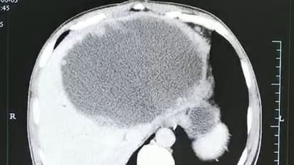 വയറുവേദന മൂലം ആശുപത്രിയിലെത്തി; എക്‌സ് റേയില്‍ കണ്ടത് ഞെട്ടിക്കുന്ന കാഴ്ച...