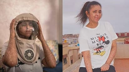 മാസ്ക് ധരിക്കാന് മടി കാണിക്കുന്നവരൊക്കെ കാണണം, ഫാത്തിമയുടെ ജീവിതം...