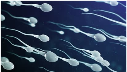 അമിതവണ്ണത്തിന് ശുക്ലത്തിന്റെ ഗുണനിലവാരവുമായി ബന്ധമുണ്ടോ? പഠനം പറയുന്നത്