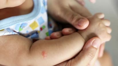 കൊതുകുകളിൽ നിന്ന് കുഞ്ഞുങ്ങളെ സംരക്ഷിക്കാം; ചെയ്യേണ്ടത് നാല് കാര്യങ്ങൾ മാത്രം