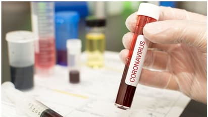 കൊവിഡ് രോഗം ഭേദമായവർക്ക് ദീർഘനാൾ ഹൃദയസംബന്ധമായ പ്രശ്നങ്ങൾ ഉണ്ടാകാനുള്ള സാധ്യത കൂടുതലാണെന്ന് പഠനം