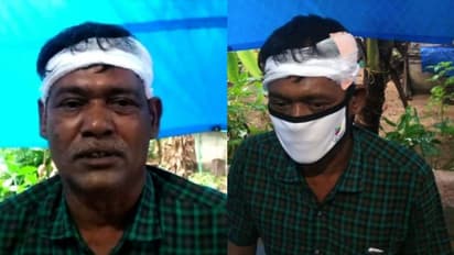 വീടിന് മുന്നിലിരുന്ന മധ്യവയസ്കനെ ലാത്തികൊണ്ടു തലക്കടിച്ചു; പൊലീസിനെതിരെ പരാതി