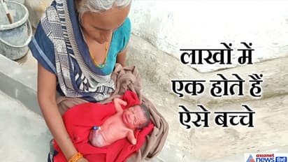 ಕೈ, ಕಾಲಿಲ್ಲದೆ ಹುಟ್ಟಿದ ಹೆಣ್ಣು ಮಗು, ದೇವರ ಪವಾಡ ಎನ್ನುತ್ತಿರುವ ಜನ