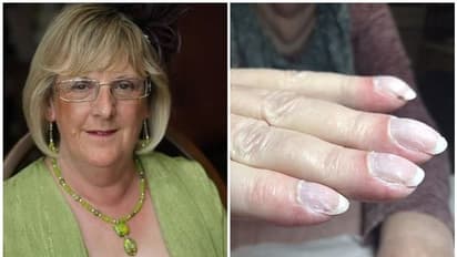 വയോധികയുടെ ജീവൻ രക്ഷിച്ചത് ബ്യൂട്ടീഷന്റെ കരുതൽ, മാനിക്യൂറിനിടെ തോന്നിയ സംശയം വെളിപ്പെടുത്തിയത് ശ്വാസകോശാർബുദം