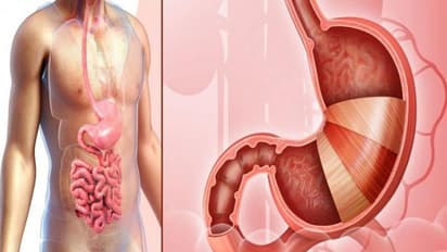 ಒಣದ್ರಾಕ್ಷಿ ಜೊತೆ ಮೊಸರು ಸೇವಿಸಿ.... ಅದು ಮಾಡುವ ಮ್ಯಾಜಿಕ್ ನೋಡಿ