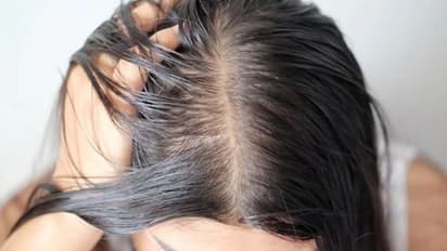 'ഓയിലി ഹെയര്‍' ഉള്ളവര്‍ മഴക്കാലത്ത് ഇക്കാര്യങ്ങള്‍ ശ്രദ്ധിക്കുക...