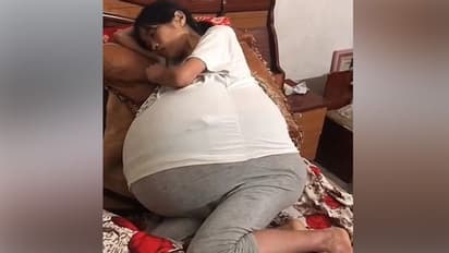 బెలూన్ లాగా పెరిగిపోయిన మహిళ పొట్ట.. దాదాపు 19కేజీలు పెరిగి..