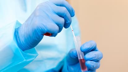 Covid 19 Death : കൊവിഡ് അനുബന്ധ മരണങ്ങളുടെ ഞെട്ടിക്കുന്ന കണക്കുമായി ലോകാരോഗ്യ സംഘടന